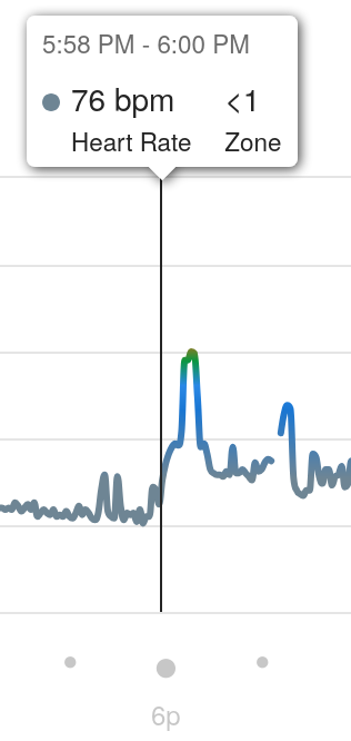 Heart rate around 76 BPM